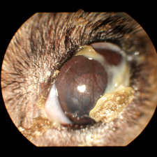 Dry Eye